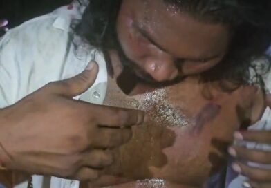 धेमोमेन में भाजपा कार्यकर्ता के परिवार पर जानलेवा हमला,  घर में घुसकर मारपीट का आरोप