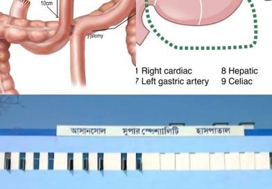 আসানসোল জেলা সুপার স্পেশালিটি হাসপাতালে ক্যান্সার রোগীর জটিল অস্ত্রোপচার
